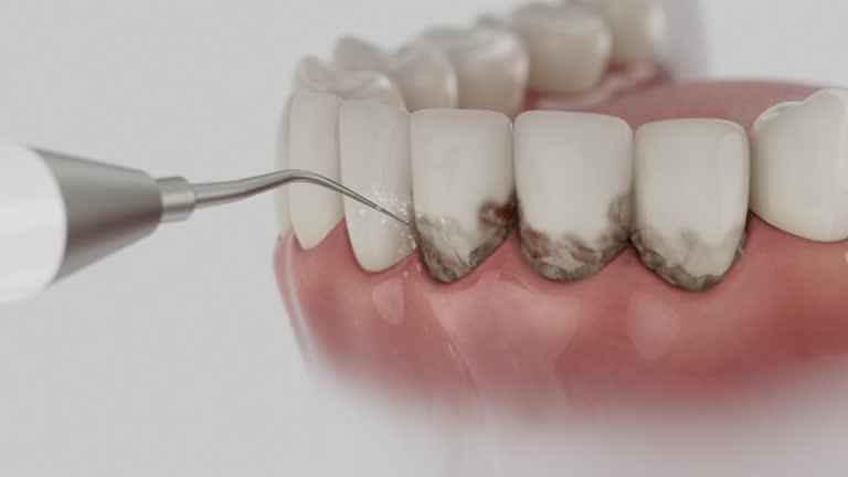Reliable Emergency Dentist contractor in Watergate, FL by Smile Center Dentistry